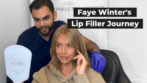 Faye Winter Lip Filler Journey